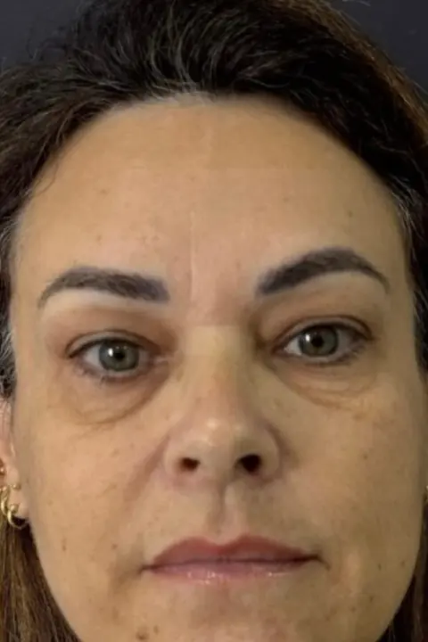 Antes: rosto com expressão cansada